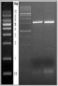 PCR을 통해 증폭된 CYP/7513, CYP/5728 유전자. lane1: size marker, lane2: 5728, lane3:7513