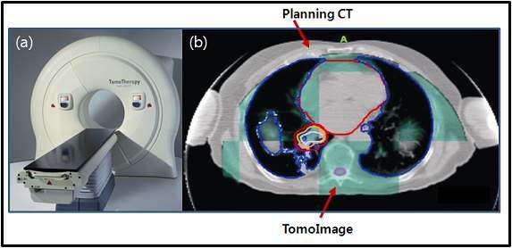 IGRT system of the tomotherapy.