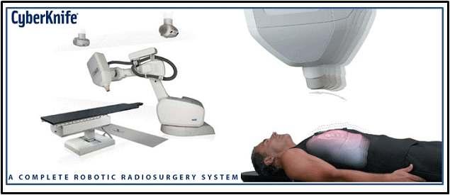 The systems of the CyberKnife which could be the gating system.