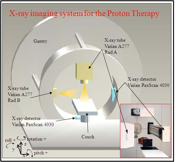 The DIPS (Digital Imaging Patient Setup) imaging system forproton therapy.