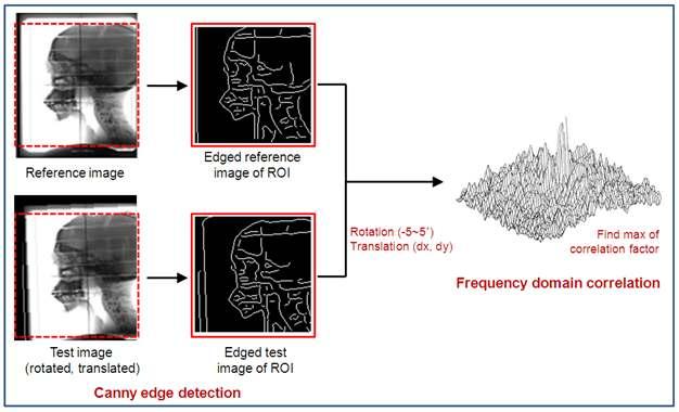 Process of automatic patient positioning, based on image correlation using DFT correlation between the edged test and edged reference images.