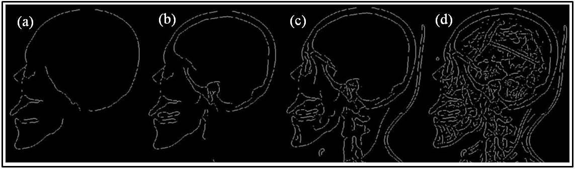 A series of edged sagittal x-ray images of the human head obtained with the Canny edge detection methods using threshold values of (a) 0.8, (b) 0.4, (c) 0.2, and (d) 0.1.