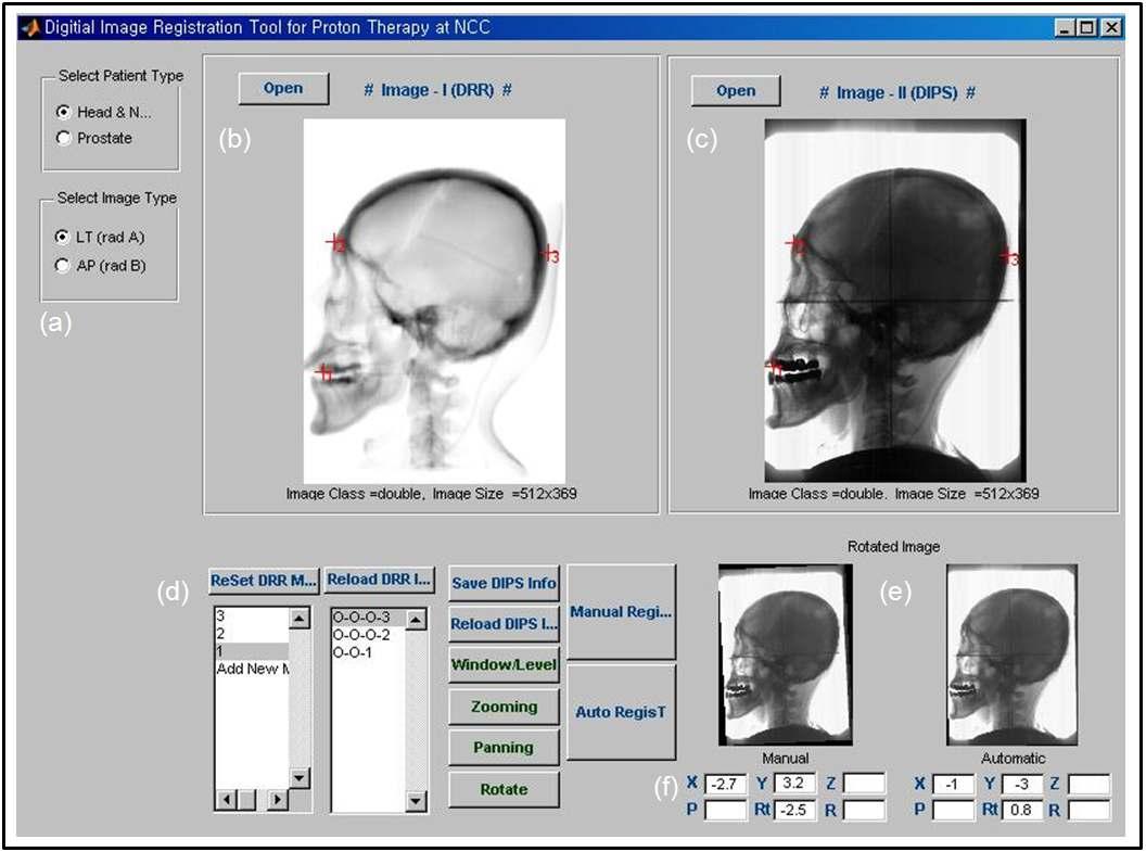 Graphic User Interface (GUI) of the developed digital image alignment system using by the Canny edge algorithm.