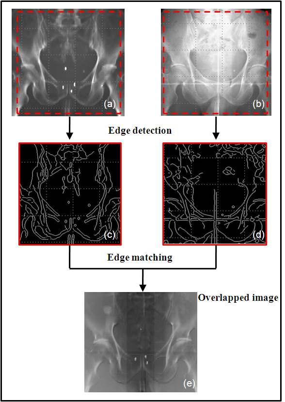 Process of automatic patient positioning based on image correlation using digital Fourier Transform (DFT)correlation between edged test and edged reference images.