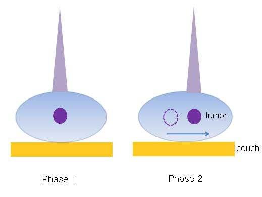 Schematic of treatment simulation for deformable tumor using 4D-CT