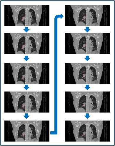 10개의 phase로 이루어진 CT set를 이용한 종양의 위치와 phase의 상관관계.
