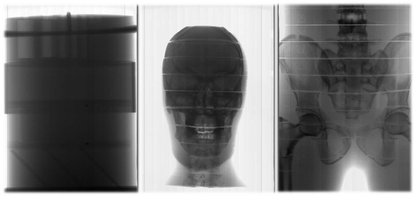 Head & neck (좌), pelvis (우) humanoid phantom의 투과영상.