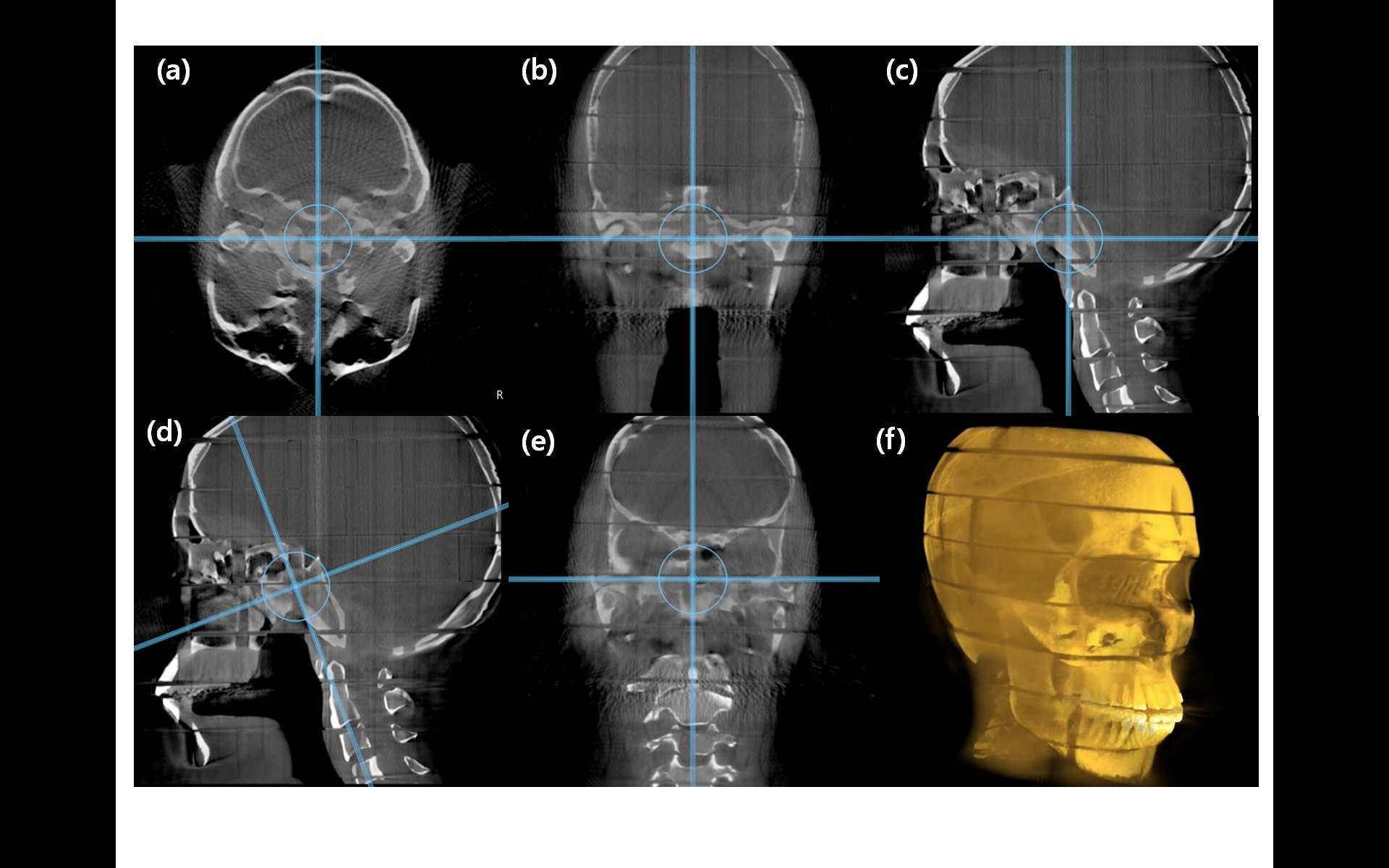 Head & neck humanoid phantom의 CT 결과 영상.
