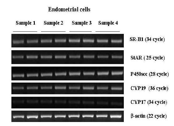 Steroidogenesis에 관여하는 유전자 발현 변화