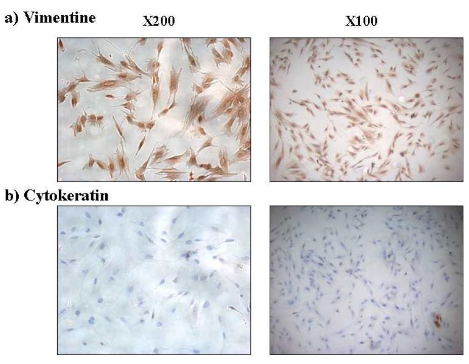 Fig.1. Vimentine and cytokeratin in primary endometrial stromal cells, as mesured by Immunocytochemistry analysis.