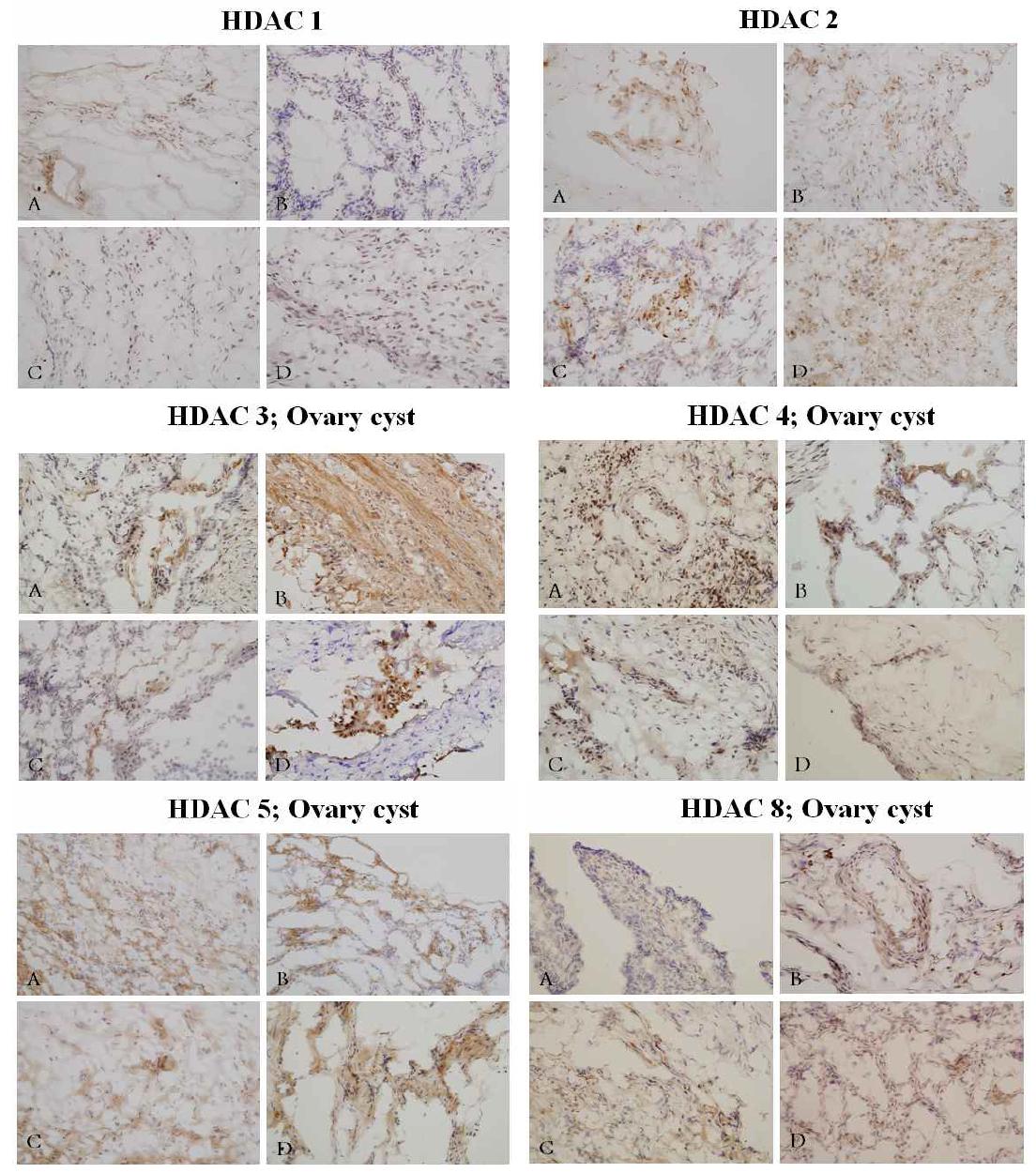 Immunohistochemical analysis of HDAC1, HDAC2, HDAC3, HDAC4, HDAC5 and HDAC8 expression in eutopic endometrium.