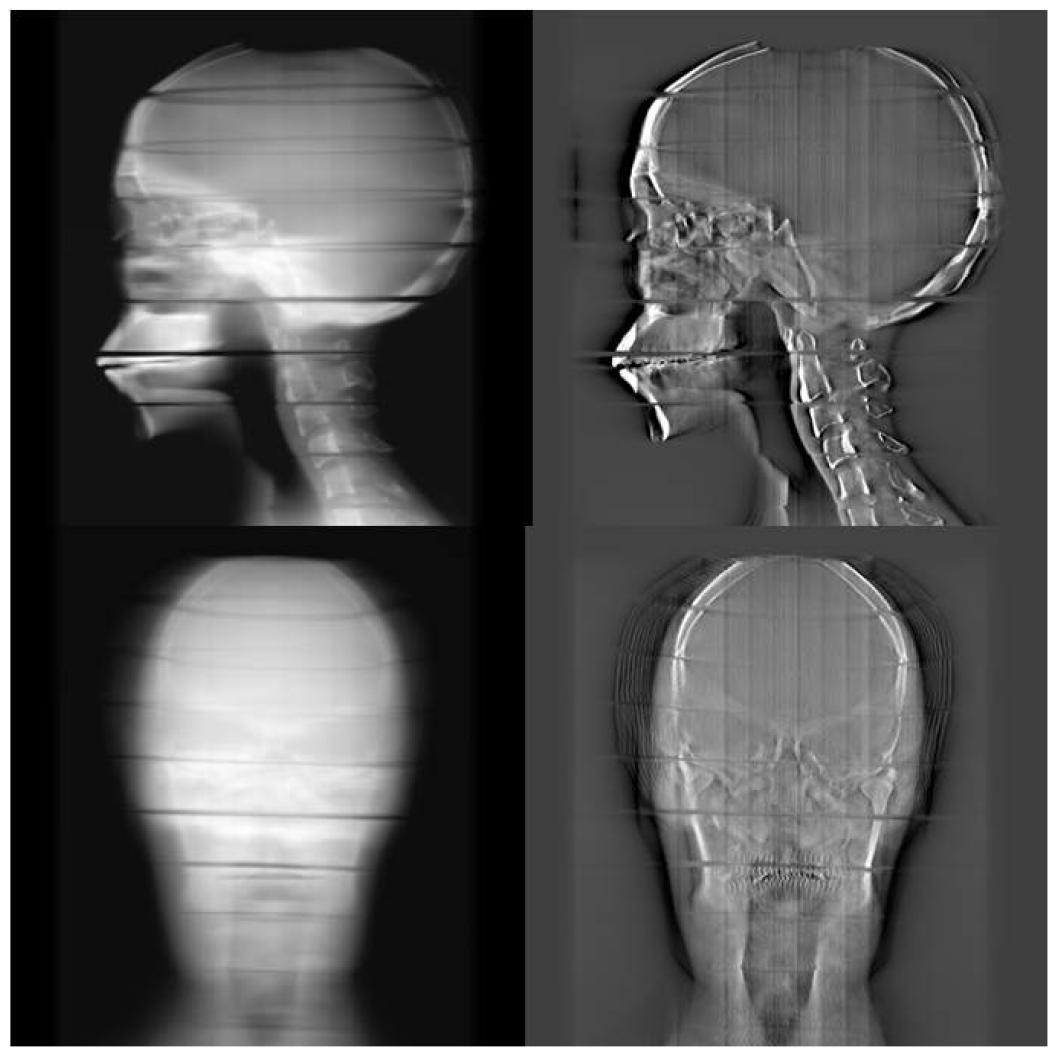 CBDT (Cone-Beam Digital Tomosynthesis) 결과 영상,