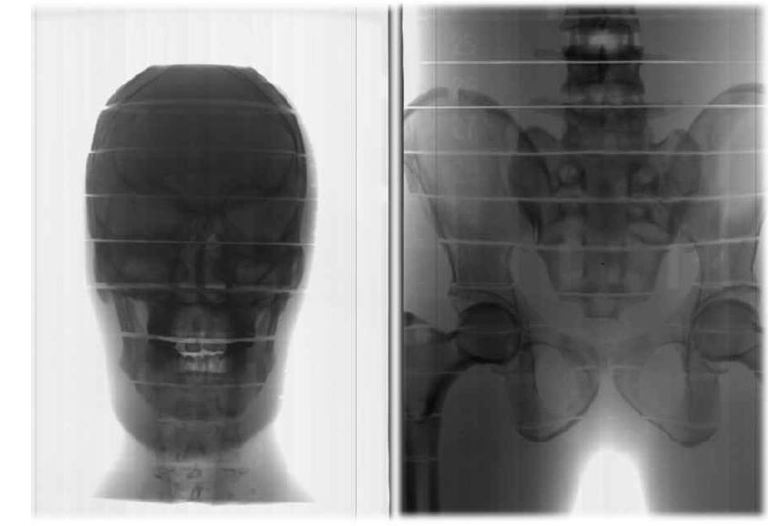 Head & neck (좌), pelvis (우) humanoid phantom의 투과영상.