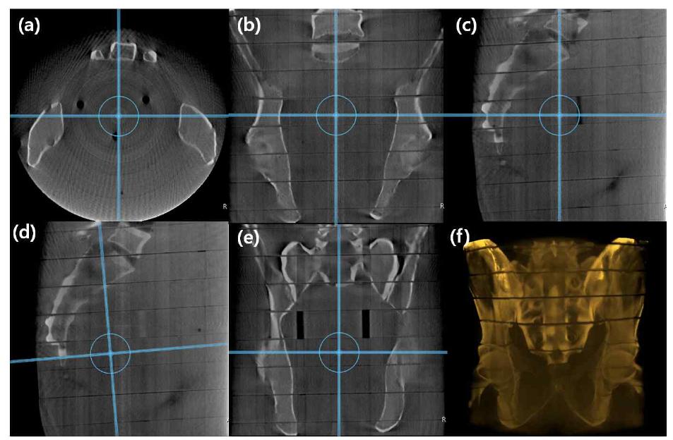 Pelvis humanoid phantom의 CT 결과 영상.