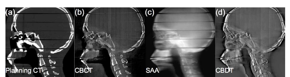 인체모사 팬텀의 sagittal 영상.