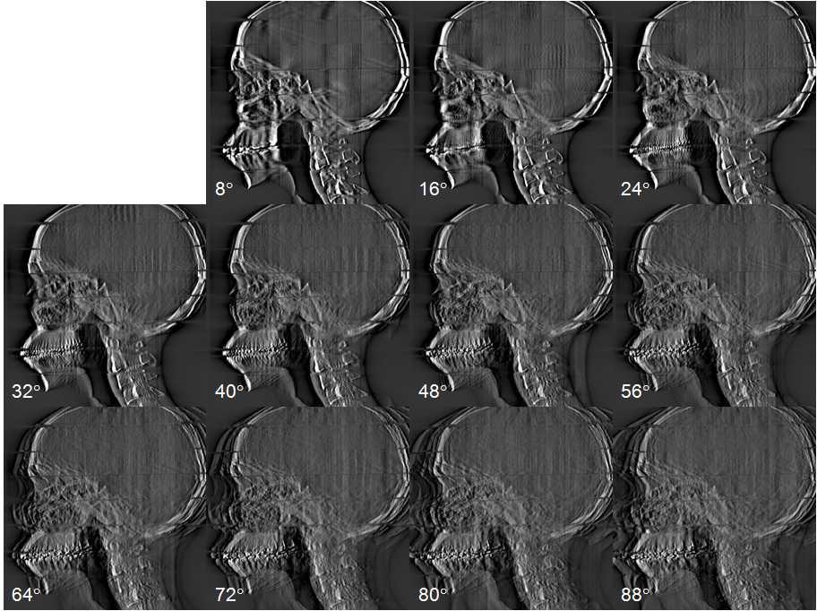 인체모사 팬텀의 sagittal 영상.