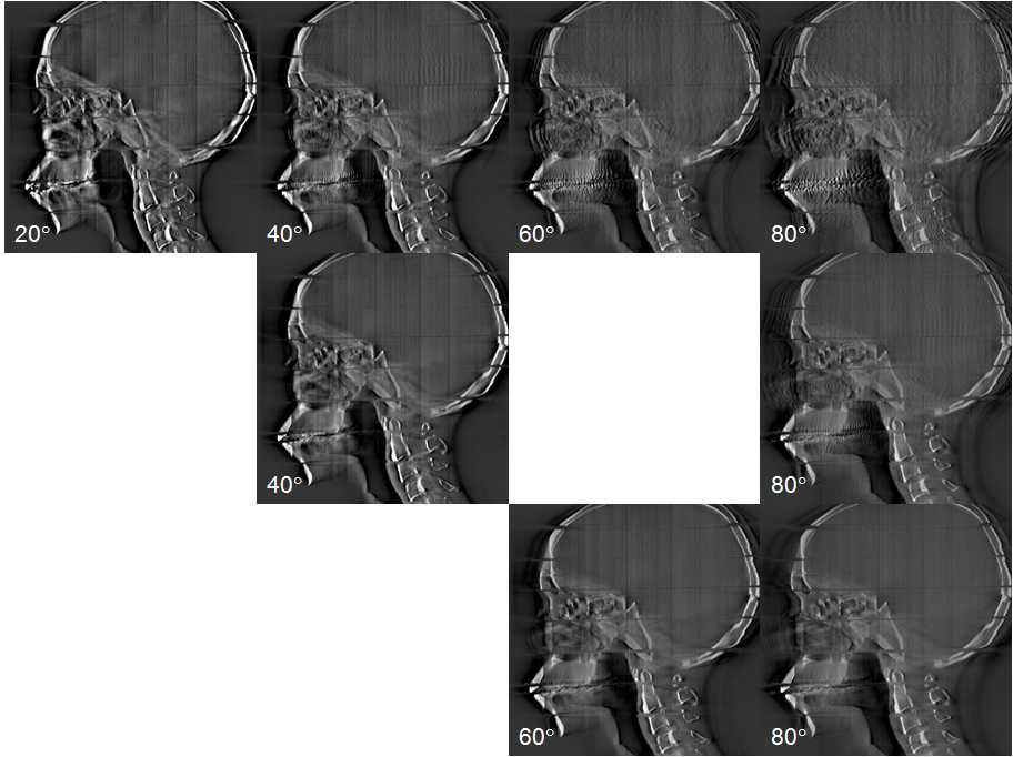 인체모사 팬텀의 sagittal 영상.