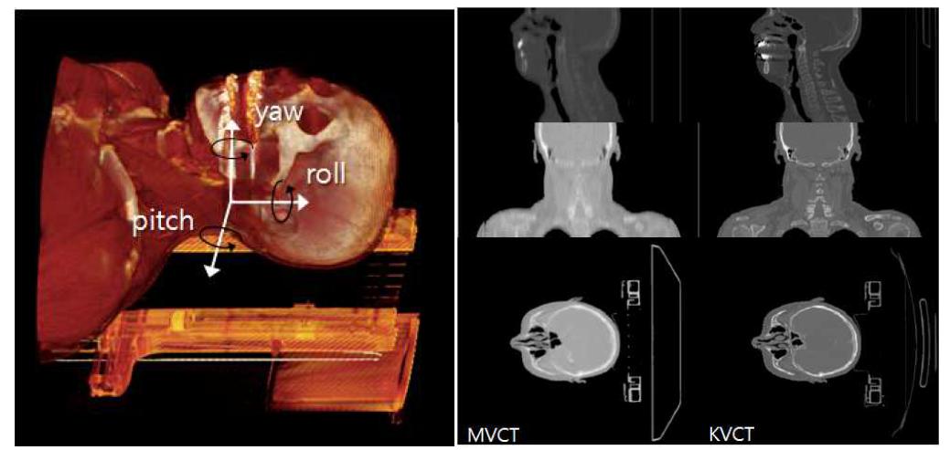 좌측은 CT데이터를 3차원 볼륨 렌더링한 영상에서 나타낸 좌표계, 우측은 비교하고자 하는 두 CT 데이터의 sagittal, coronal, axial 단층 영상