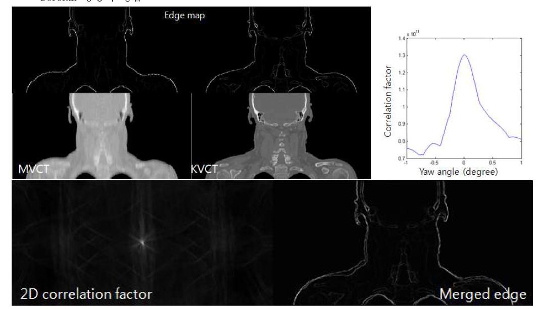 Coronal 단층영상에서의 결과