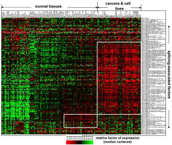 Normal tissue와 cancer 및 cancer cell line에서 splicing factor의 발현의 비교.