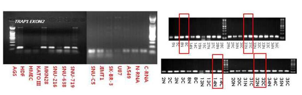 TRAP1의 splice variation을 RT-PCR로 validation한 결과.