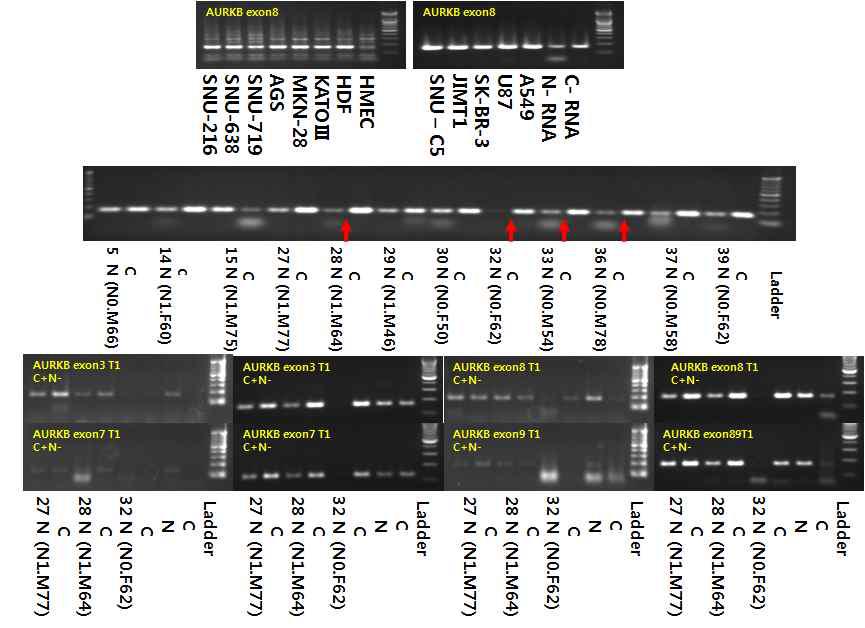 AURKB의 splice variation을 RT-PCR로 validation한 결과.