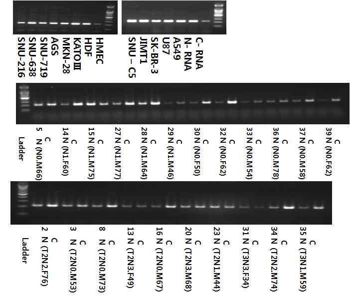 FLJ22374의 splice variation을 RT-PCR로 validation한 결과.