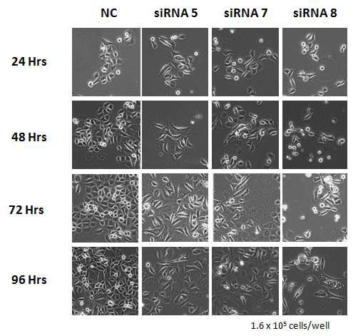 세가지 FLJ22374특이적 siRNA에 의한 cell proliferation에 대한 영향을 96시간 동안 24 시간 간격으로 현미경하에서 관찰한 결과.