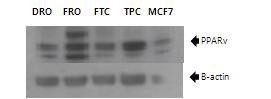 여러 가지 갑상선암에서 PPAR gamma의 발현(Western Blot)