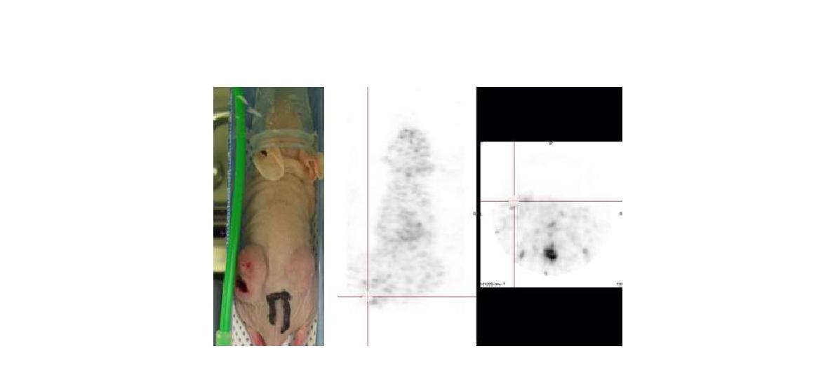 재분화유도제(Pioglitazone)처리한 갑상선암모델에서 NIS발현을 반영하는 분자영상 - Tc-99m pertechnate SPECT 영상.