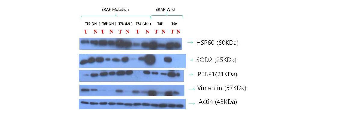 HSP60, SOD2, PEBP1, and vimentin expression status were matched with 2D gel electrophoresis results. T:tumor, N: Normal tissue.