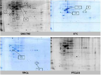 2DE protein profiles of XTC, TPC1, SNU790 and FTC133 cell line