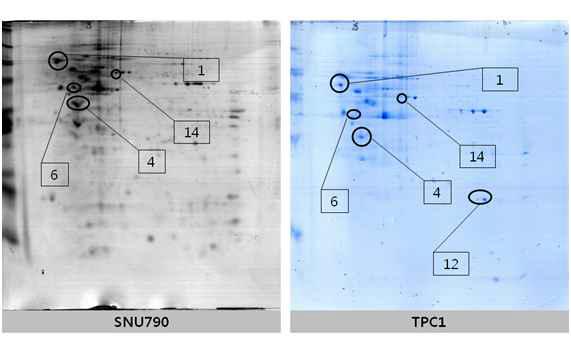 Different protein spots between SNU790 and TPC1 cell line