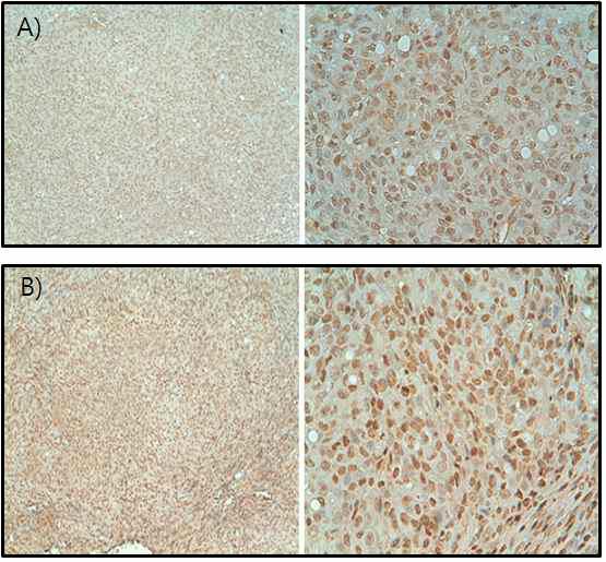 DRO90 조직에서 NIS(Sodium iodide symporter) 조직염색.