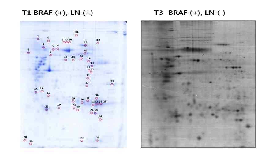 림프절전이 양성군에서 발현 증가한 단백질 (10개): Calreticulin, HSP60, gelsolin, tropomycin alpha, Cathepsin B, PEBP1, SOD2, LAMININ A, Triosephosphate isomerase, LAP3, 림프절전이 음성군에서 발현이 감소한 단백질 (2개): Aconitate hydrase, vimentin