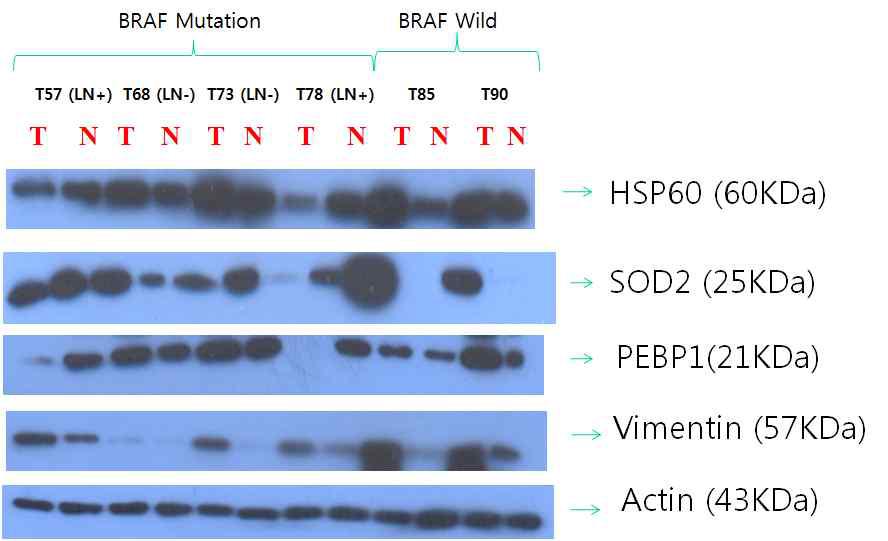 HSP60, SOD2, PEBP1, and vimentin expression status were matched with 2D gel electrophoresis results.