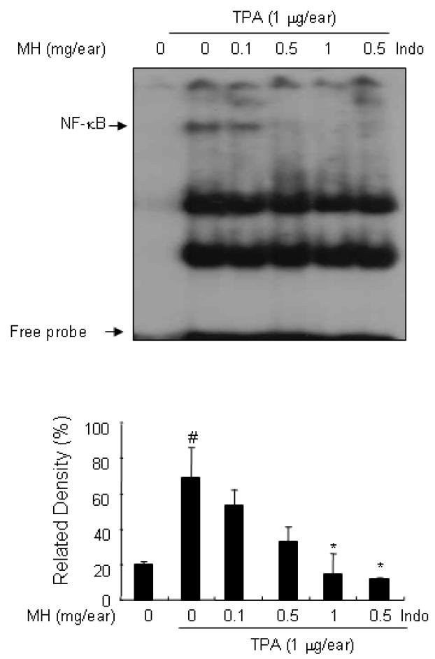 BL153-AS의 TPA에 의한 염증 유발 Mouse ear에서의 NF-κB 활성 억제 효과