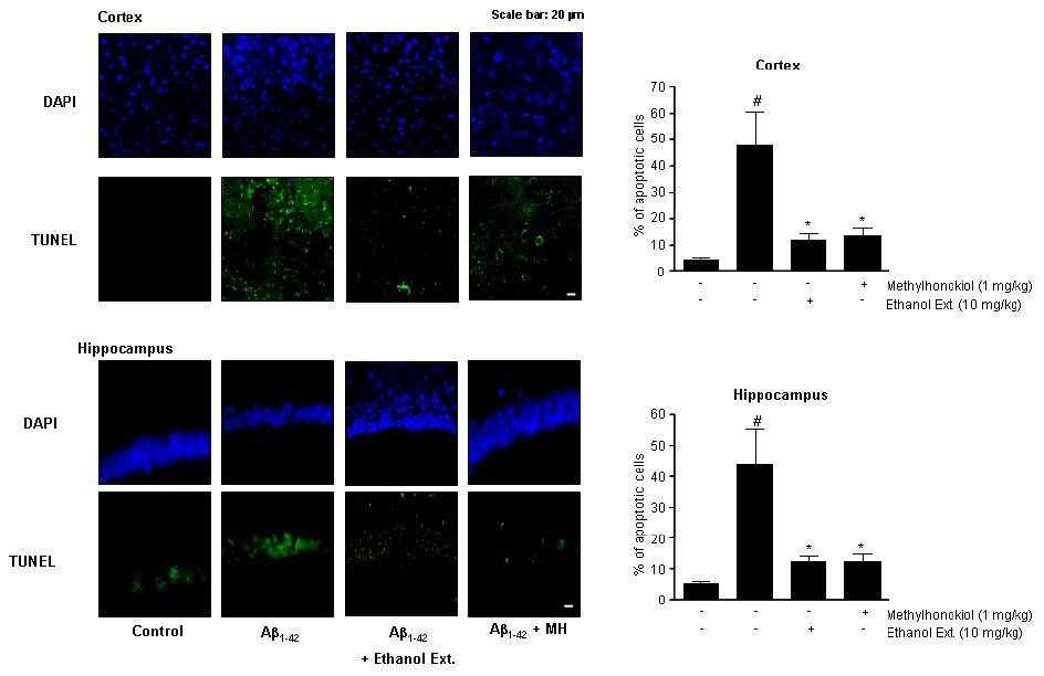 아밀로이드 투여에 의한 치매 동물에서 BL153의 신경 세포사 억제효과