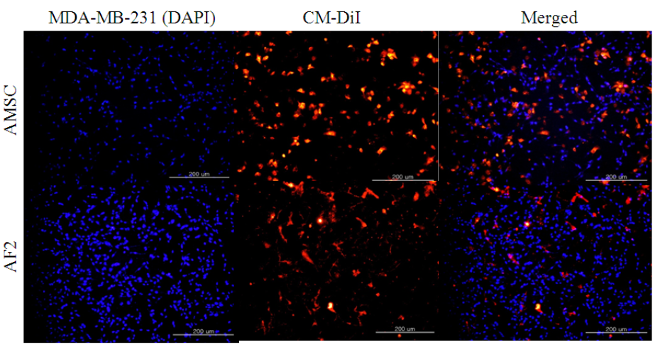 붉은색 형광을 나타내는 CM-DiI로 염색한 줄기세포주인 AMSC와 AF2 세포가 파란색의 DAPI로 염색된 유방암세포주 MDA-MB-231으로 이주성 평가.