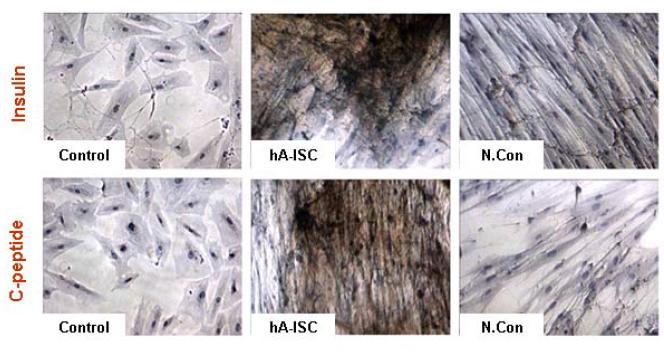 면역화학염색법을 이용한 insulin 및 C-peptide 단백질 발현 분석