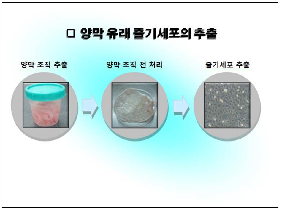 양막 유래 줄기세포 추출법에 관한 전반적 흐름