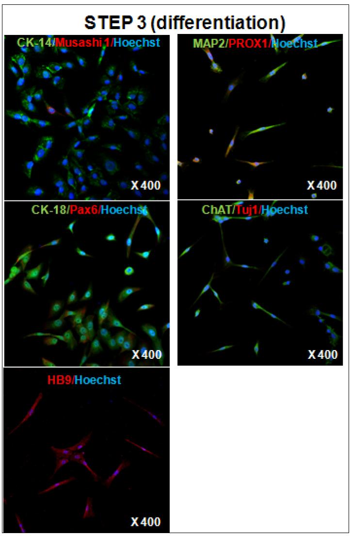 분화 3단계의 줄기세포의 신경 관련 성상 확인