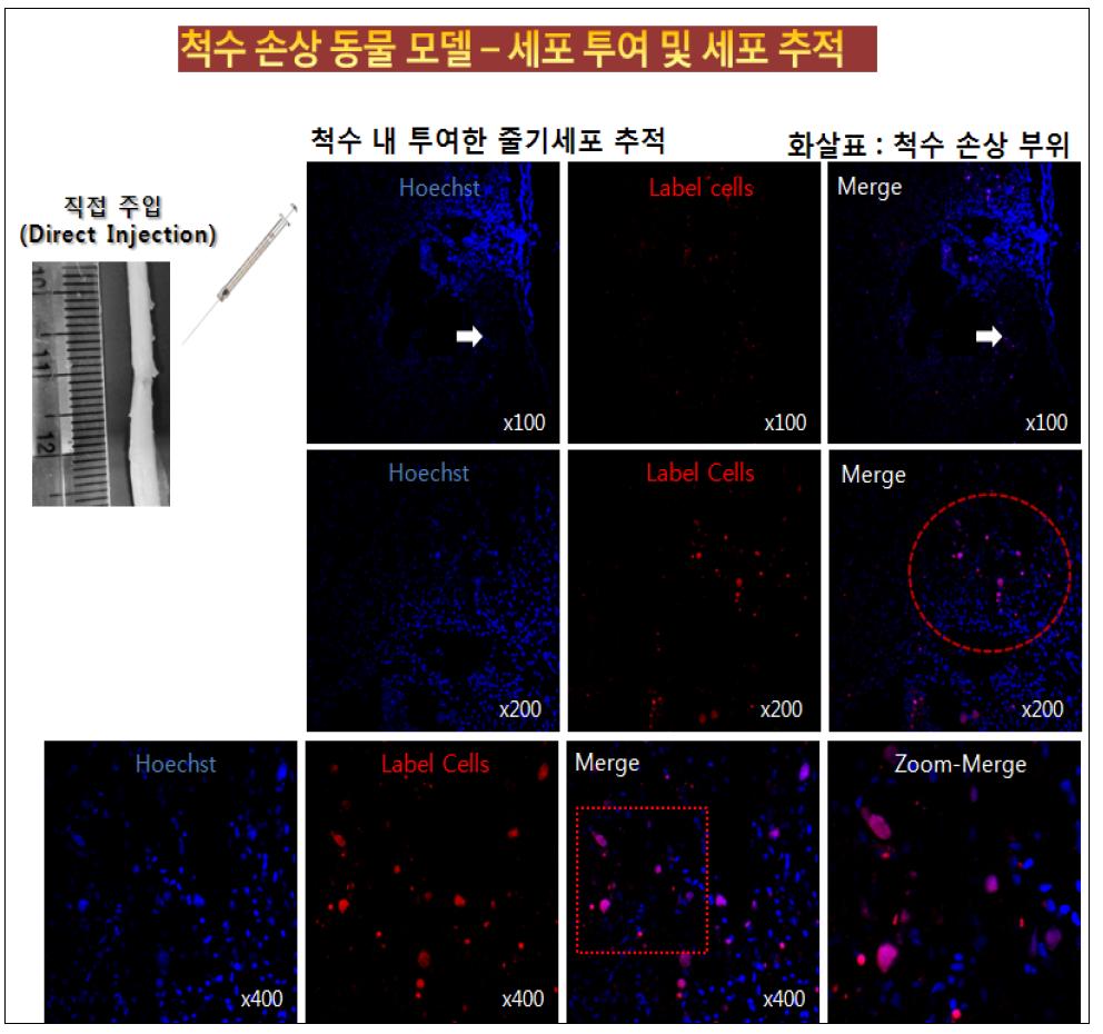 손상 부위에 직접 줄기세포 투여