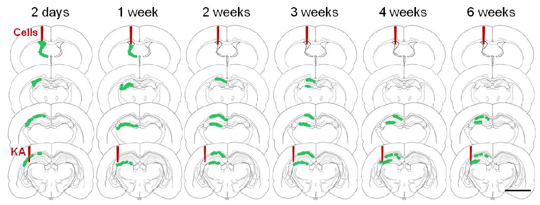 ChAT expression and differentiation into astrocytes and neurons after intracerebroventricular transplantation of F3.ChAT human neural stem cell line.