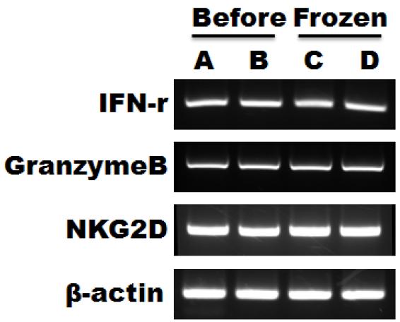 RT-PCR을 통한 mRNA 수준에서 동일성 분석