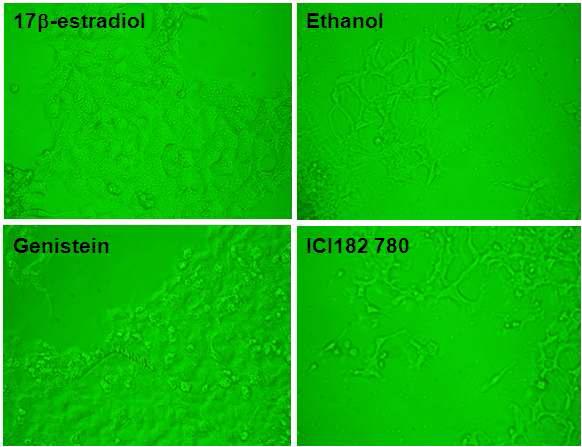 에스트로겐 reference chemical에 대한 세포독성 관찰