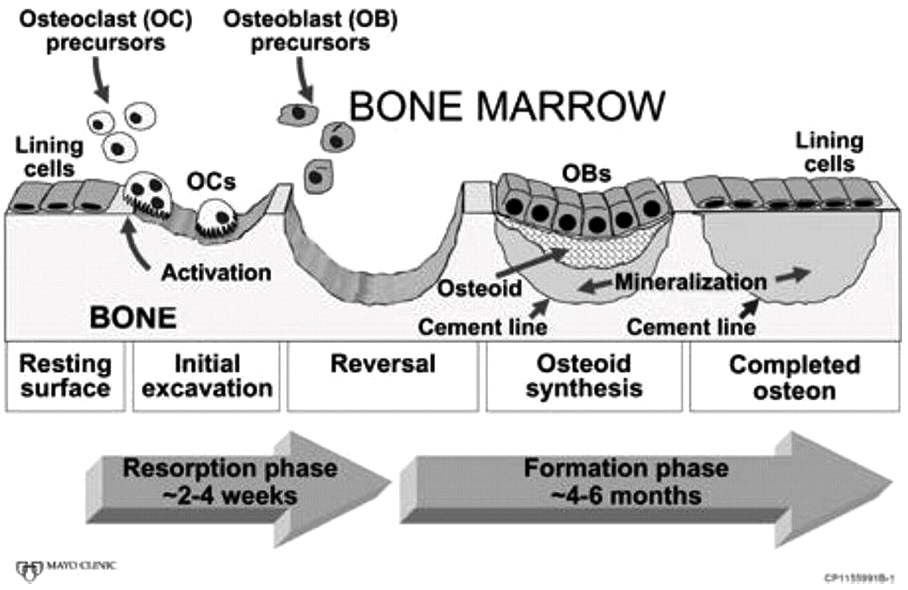그림 1-1. 뼈의 재형성 과정
