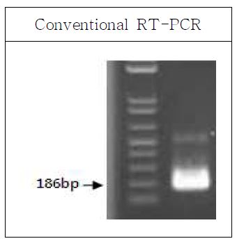 그림20. 시험법 개발에 사용할 A형 간염바이러스의 PCR 증폭 확인결과