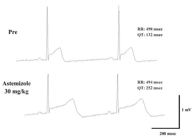 Astemizole(양성대조물질) 처리 전과 후(2시간)의 ECG 파형