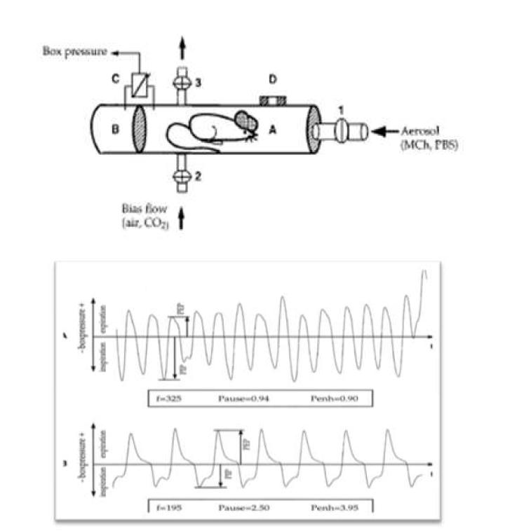 Changes in box pressure waveform after methacholine challenge.